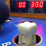 Whack a Molar branded game for a dentist office in Sacramento